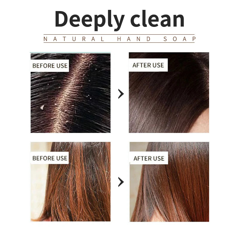 Lavender Shampoo – Refreshing, Oil-Control & Silicone-Free