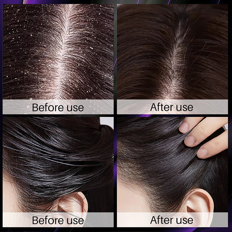 Hair Growth & Thickening Shampoo – Rosemary & Onion Formula