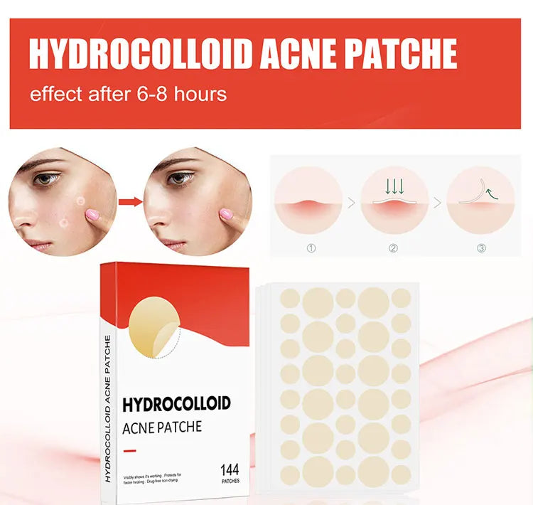 144pcs Acne Pimple Patch Set – Invisible Spot Stickers in 2 Sizes