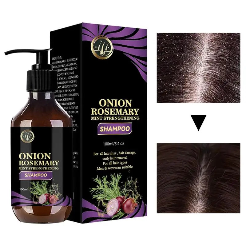 Hair Growth & Thickening Shampoo – Rosemary & Onion Formula