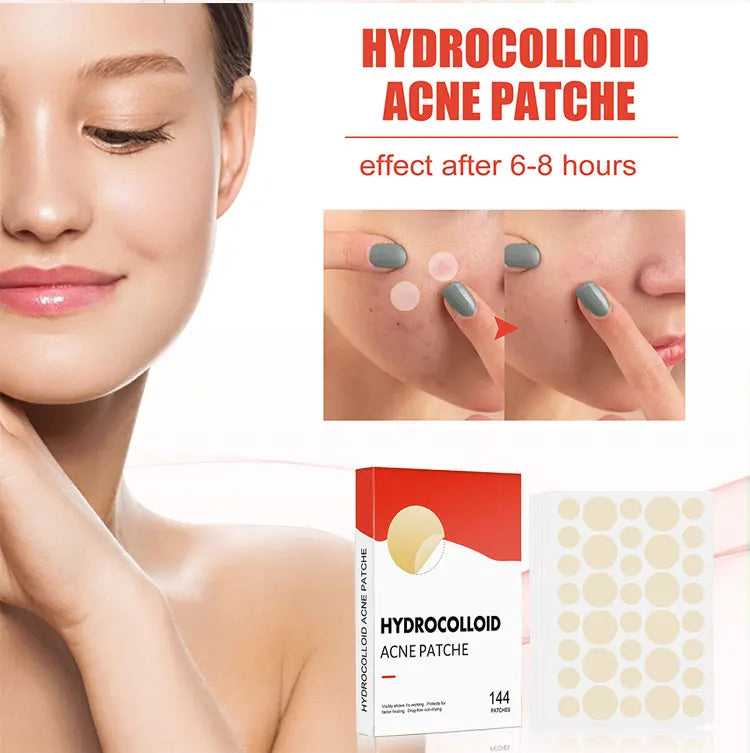 144pcs Acne Pimple Patch Set – Invisible Spot Stickers in 2 Sizes