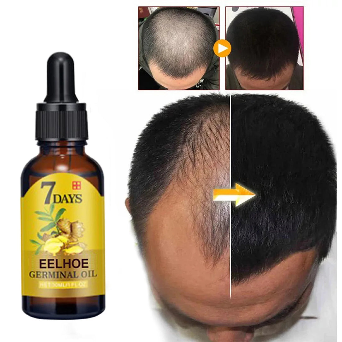 Ginger Hair Care Essence – Anti-Hair Loss & Root Strengthening Serum