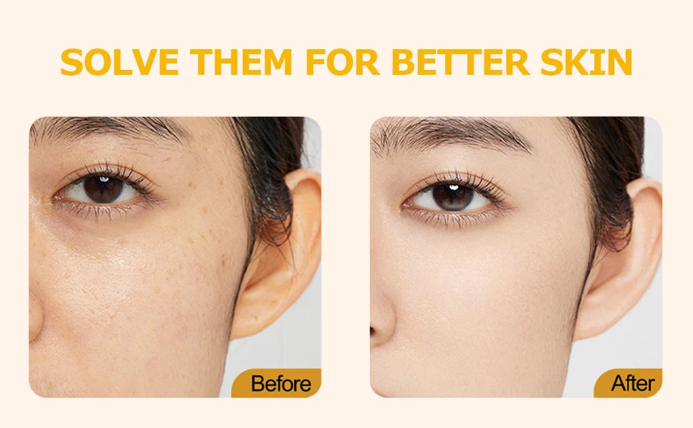Vitamin C Golden Capsule Moisturizer – Hydrating & Antioxidant Daily Care