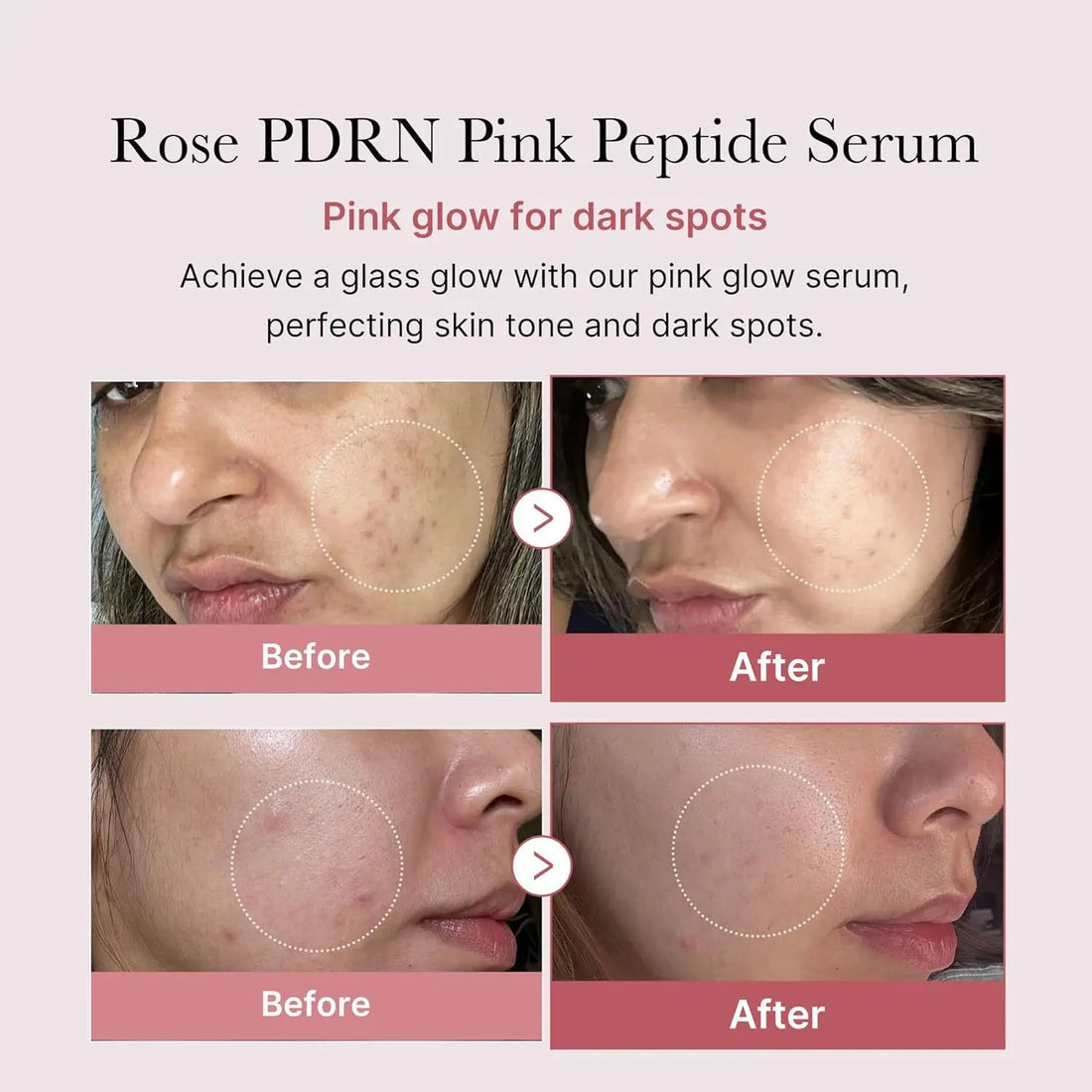 Vegan Pink Essence – Moisturizing & Firming Face Serum (30ml)
