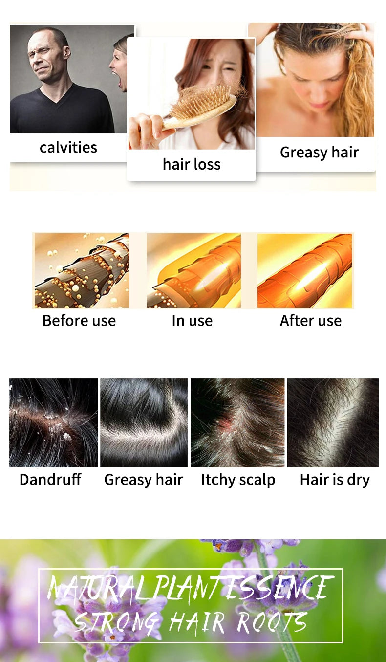 Lavender Shampoo – Refreshing, Oil-Control & Silicone-Free