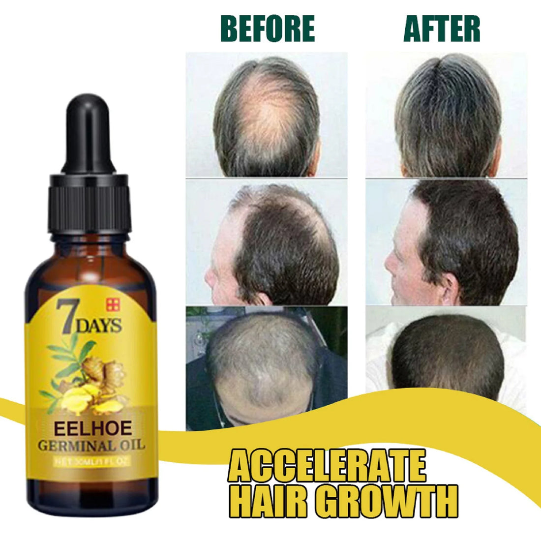 Ginger Hair Care Essence – Anti-Hair Loss & Root Strengthening Serum