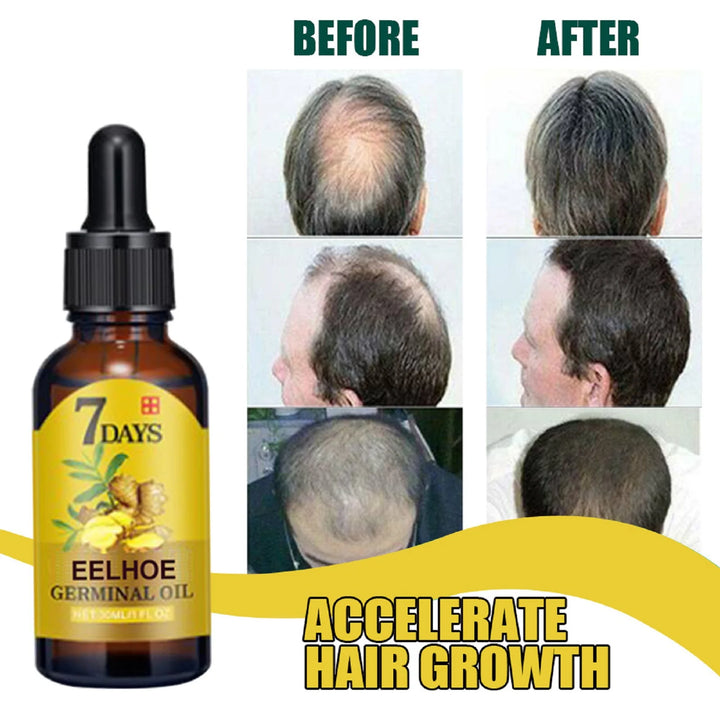 Ginger Hair Care Essence – Anti-Hair Loss & Root Strengthening Serum